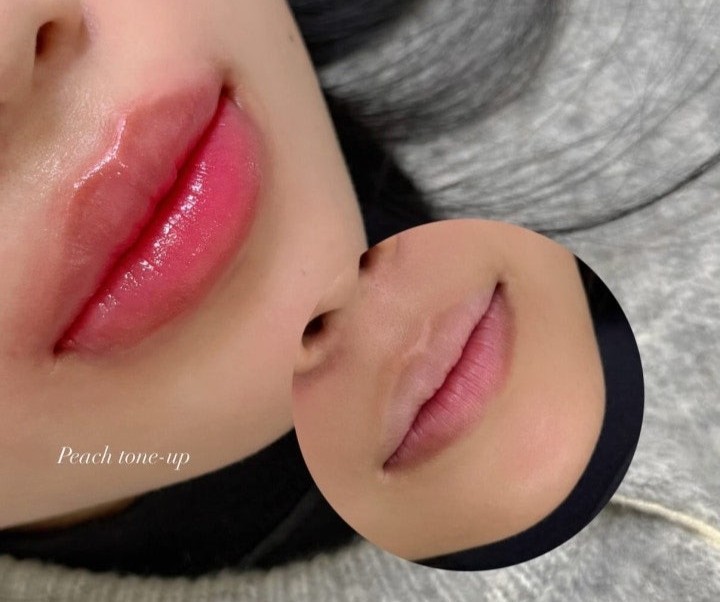 DIF.ME Dark Lip Correction treatment photo 3