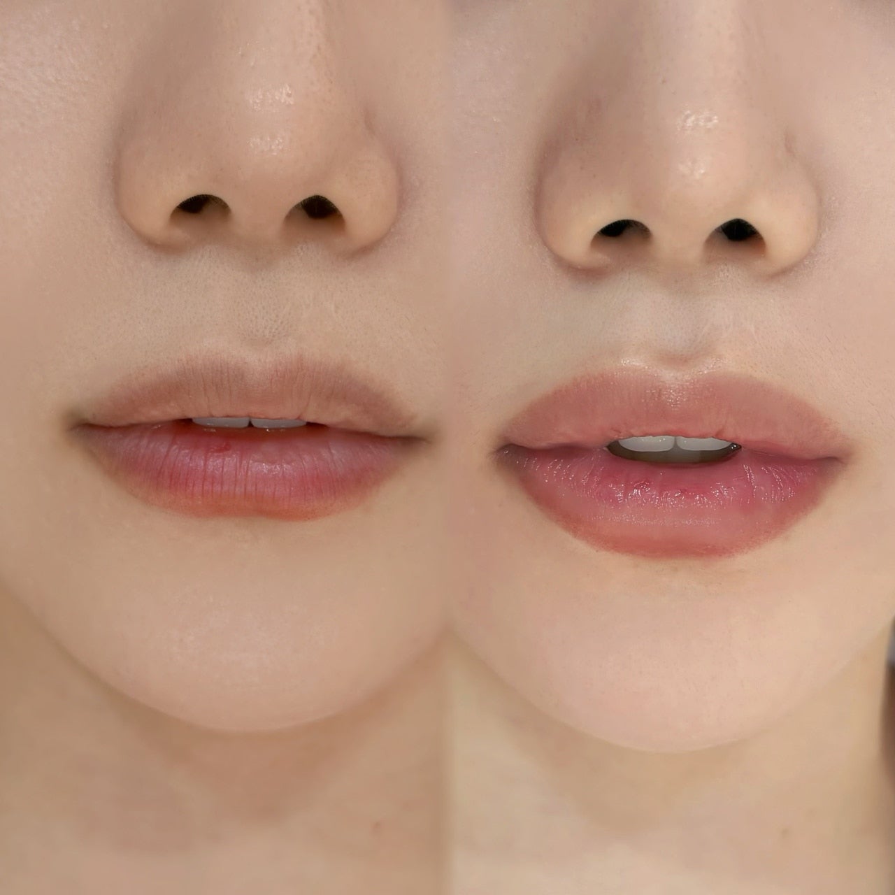 DIF.ME Lip Line result