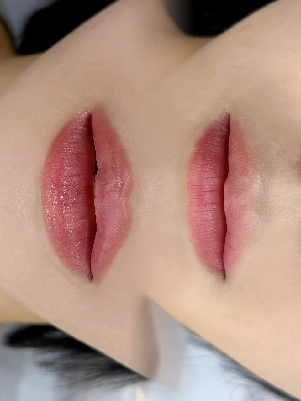 DIF.ME Lip Line treatment photo 2
