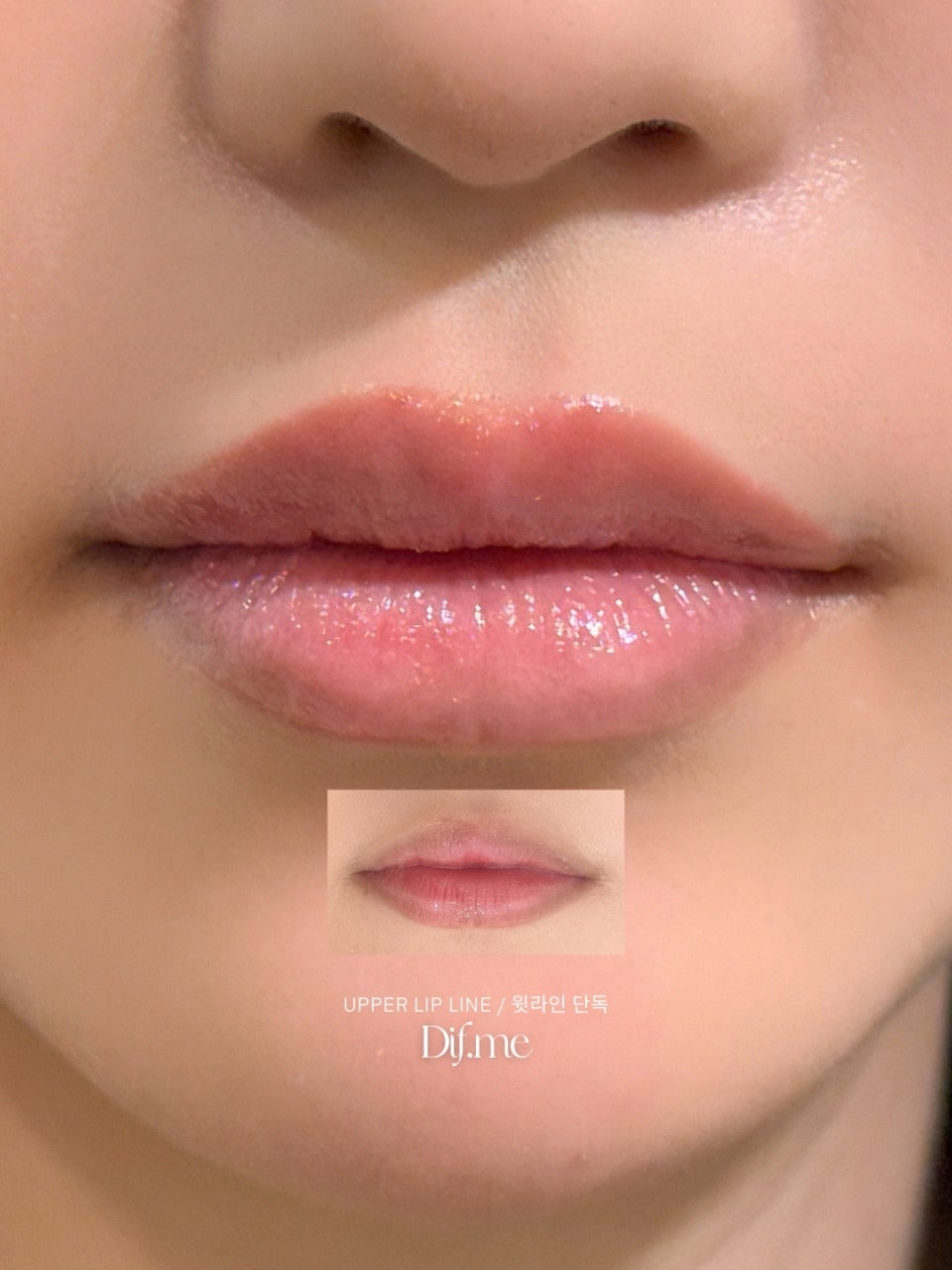 DIF.ME Lip Line treatment photo 4