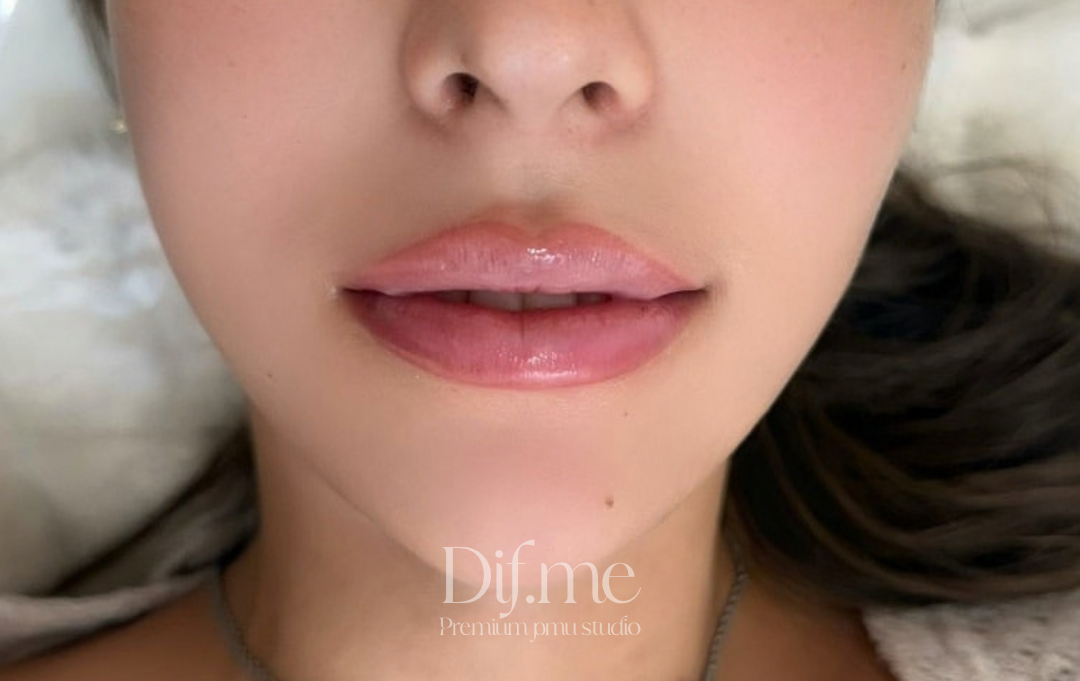 DIF.ME Lip Line treatment photo 5