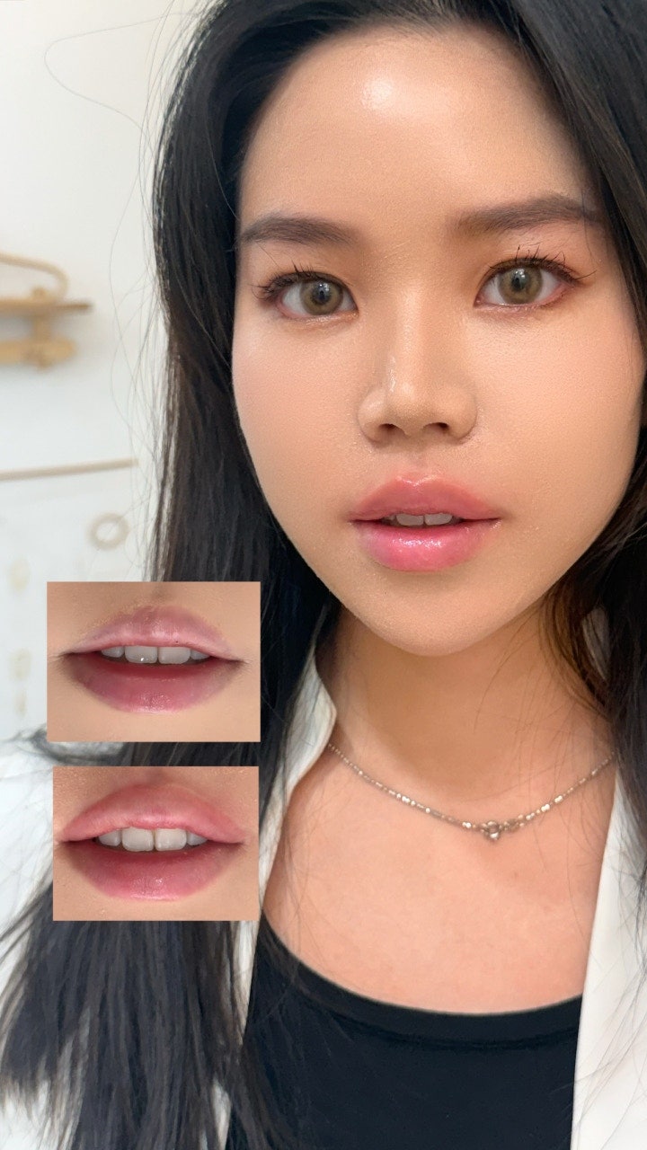 DIF.ME Lip Line treatment photo 6