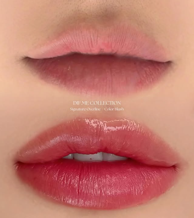 DIF.ME Over Lip before and after