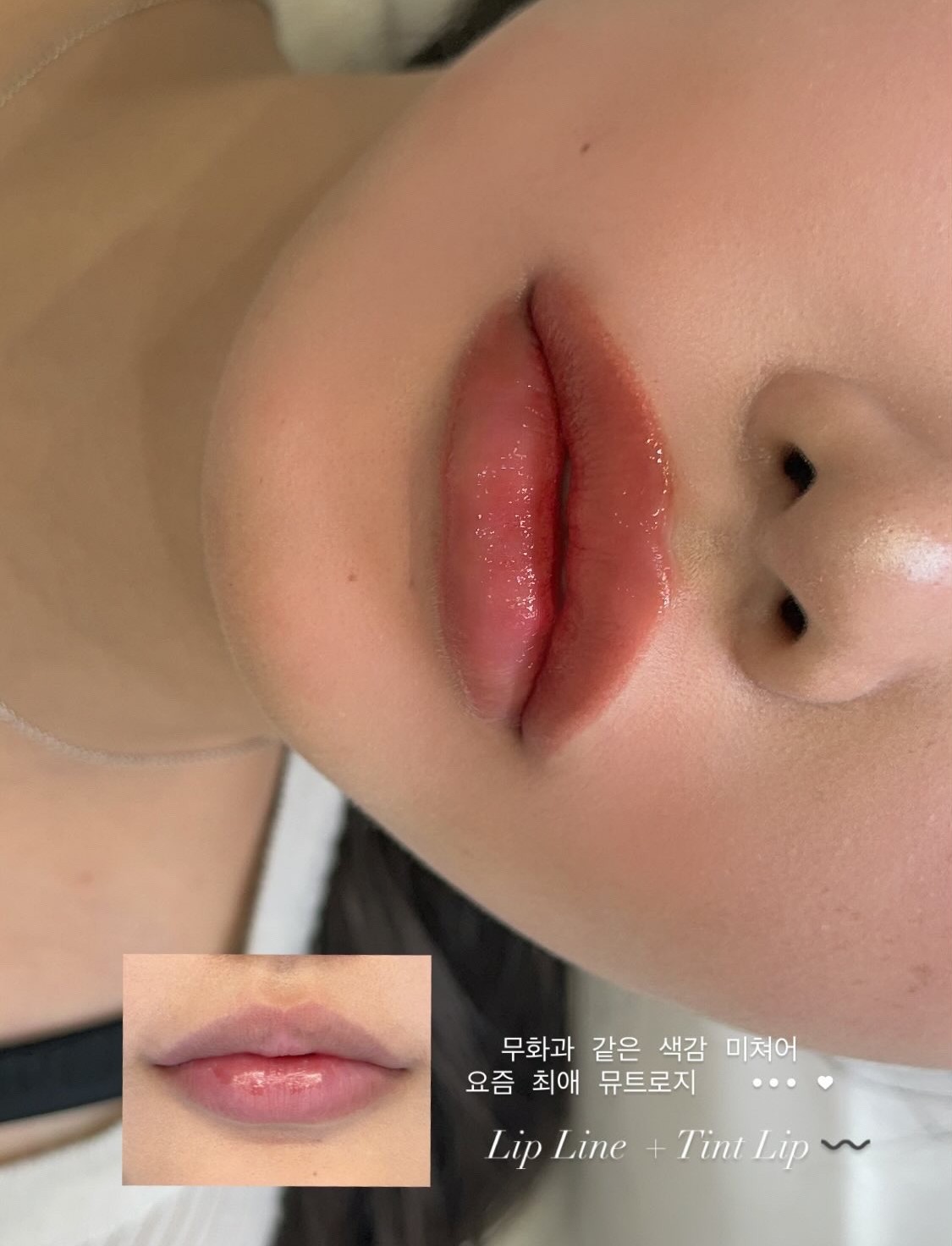 DIF.ME Over Lip treatment photo 5