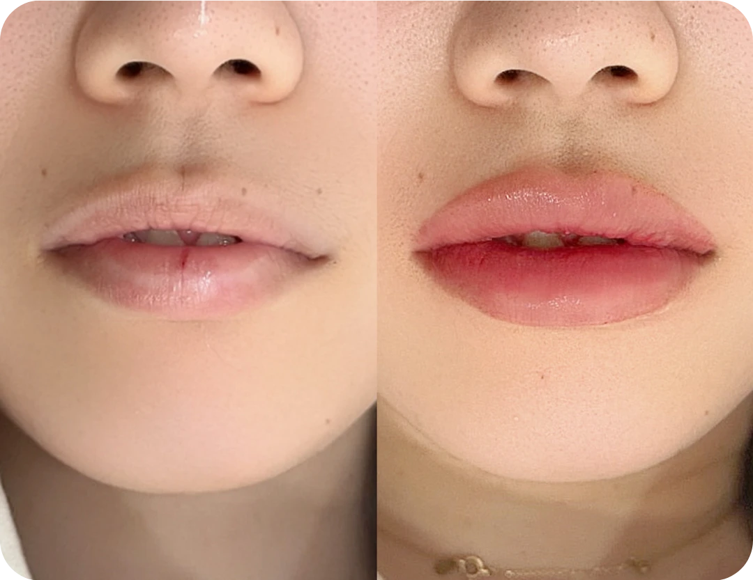 DIF.ME lip design before and after